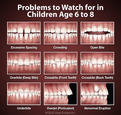 Orthodontics  Allure Dental Group